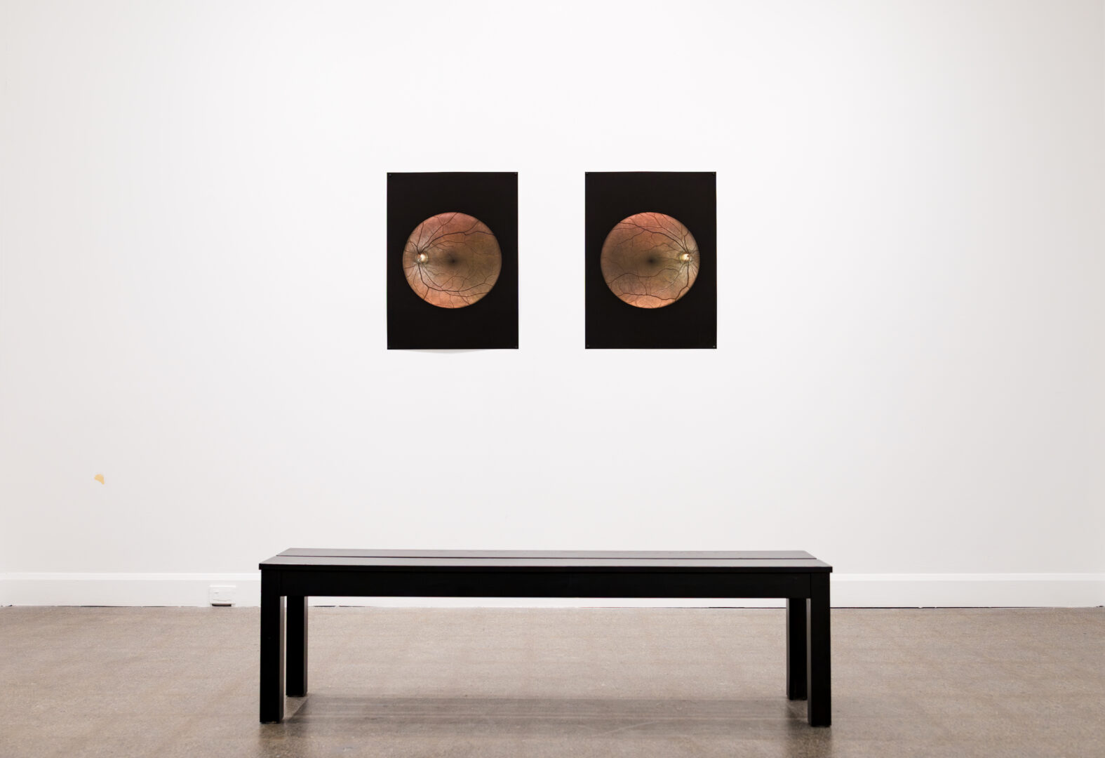 Photographie du diptyque Yeux de Nélanne Racine dans son exposition L'apparentement de Nel P. Racin. La photographie a été prise par Mathieu Chouinard, 2026. 