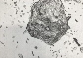 260324_photos_oeuvres_racine1